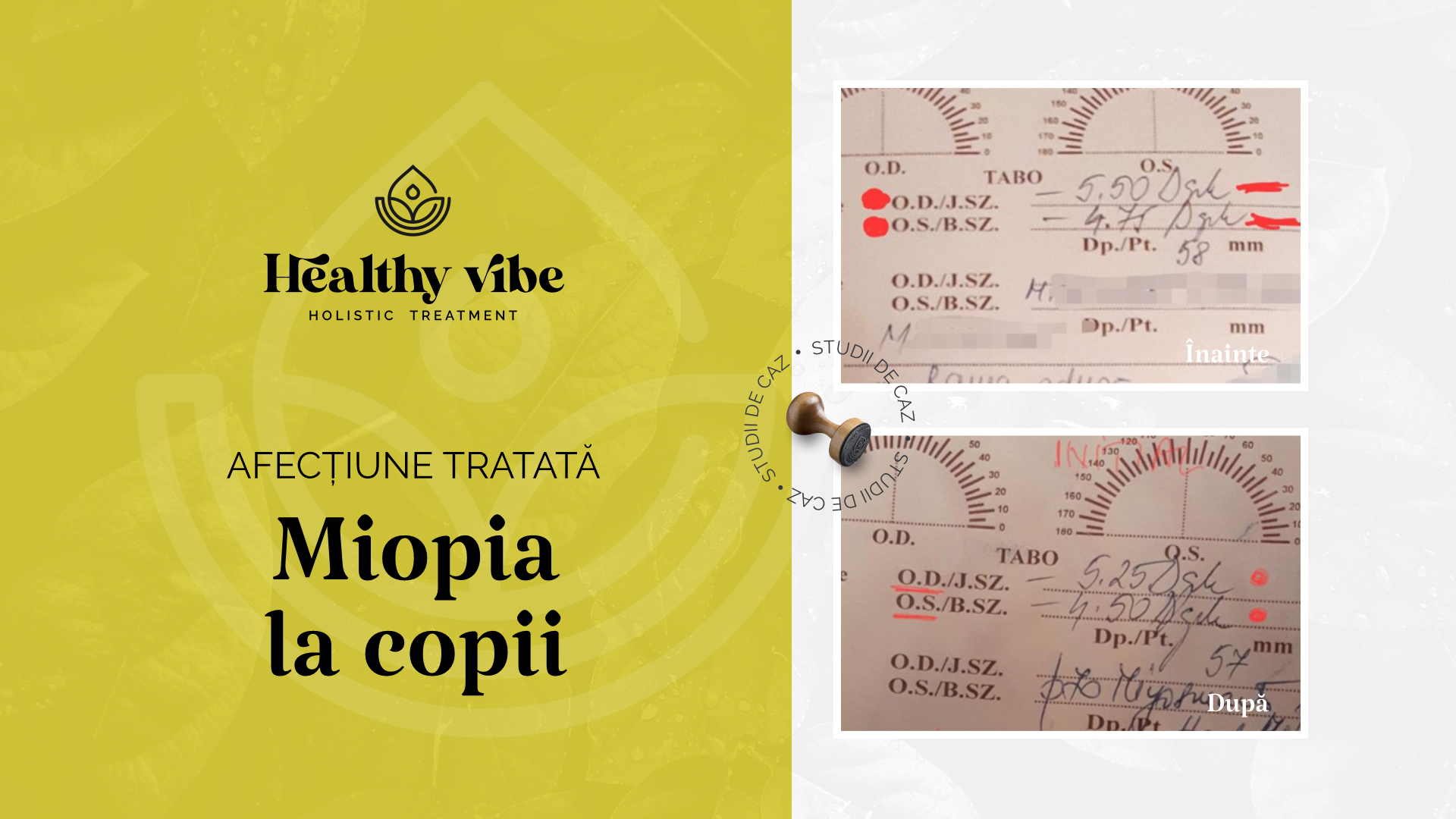 healthyvibe.ro-studii-de-caz-miopie-la-copii