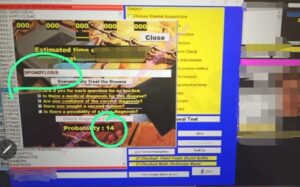 spondiloza cervicală