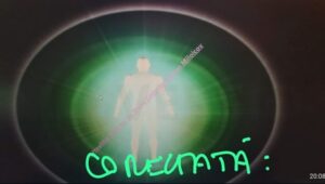 spondiloza cervicală