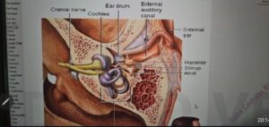 spondiloza cervicală