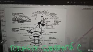 spondiloza cervicală