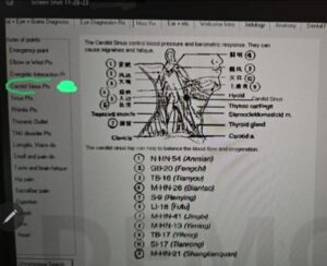 spondiloza cervicală