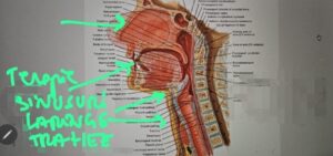 Viroză respiratorie cu laringită