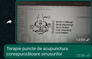 Viroză respiratorie cu laringită