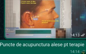 Viroză respiratorie cu laringită