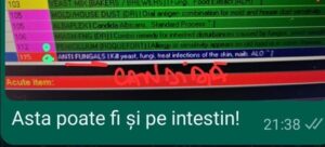 Stare generală alterată