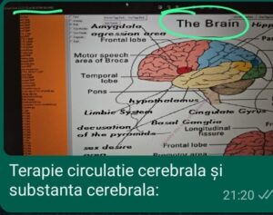 Stare generală alterată
