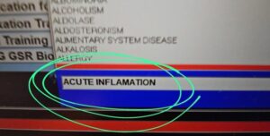 Stare generală alterată