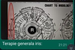 Stare generală alterată