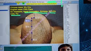 terapie prin biofeedback