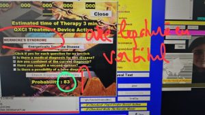 terapie prin biofeedback