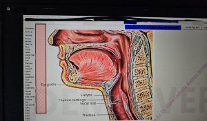 viroză respiratorie
