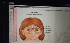 viroză respiratorie