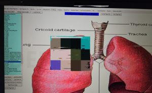 viroză respiratorie