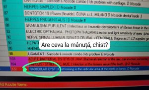 viroză respiratorie