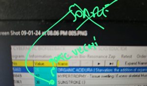 viroză respiratorie